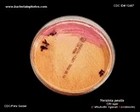 Yersinia pestis colonies on CIN agar